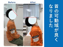 琴似じんぼ整体院/背中の痛み、整体後の変化