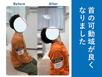 琴似じんぼ整体院/背中の痛み、整体後の変化