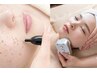 【狙い撃ちシミケア20分＆ビタミンC導入の徹底美白！】贅沢W美白コース￥5500
