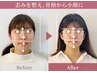 【ご新規限定65%OFF】小顔矯正とマシン施術で強力リフトアップ！60分¥9,900円
