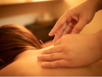 クラール鍼灸整骨院 盛岡肴町院/個室でゆったりと堪能ください♪