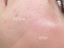 ハリウッドブロウリフトワクシー 渋谷(HOLLYWOODBROWLIFT WAXYYY.)の雰囲気（毛穴改善&お肌を土台から変える！感動のフェイシャルワックス◎）