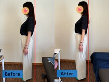 鈴家/猫背矯正/ビフォー/アフター