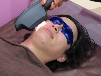 アーヒル(A”-HILU)/ヒゲ脱毛