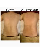 リボーテ(Re-Beaute)/3Dボディダイエット筋膜リリース