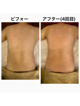 リボーテ(Re-Beaute)/3Dボディダイエット筋膜リリース