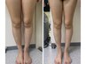 【美脚美人】【下半身デトックスカッピングスライドマッサージ】45分