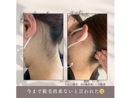 モアトゥインクル 福山宮通り店(MORE twinkle)の写真