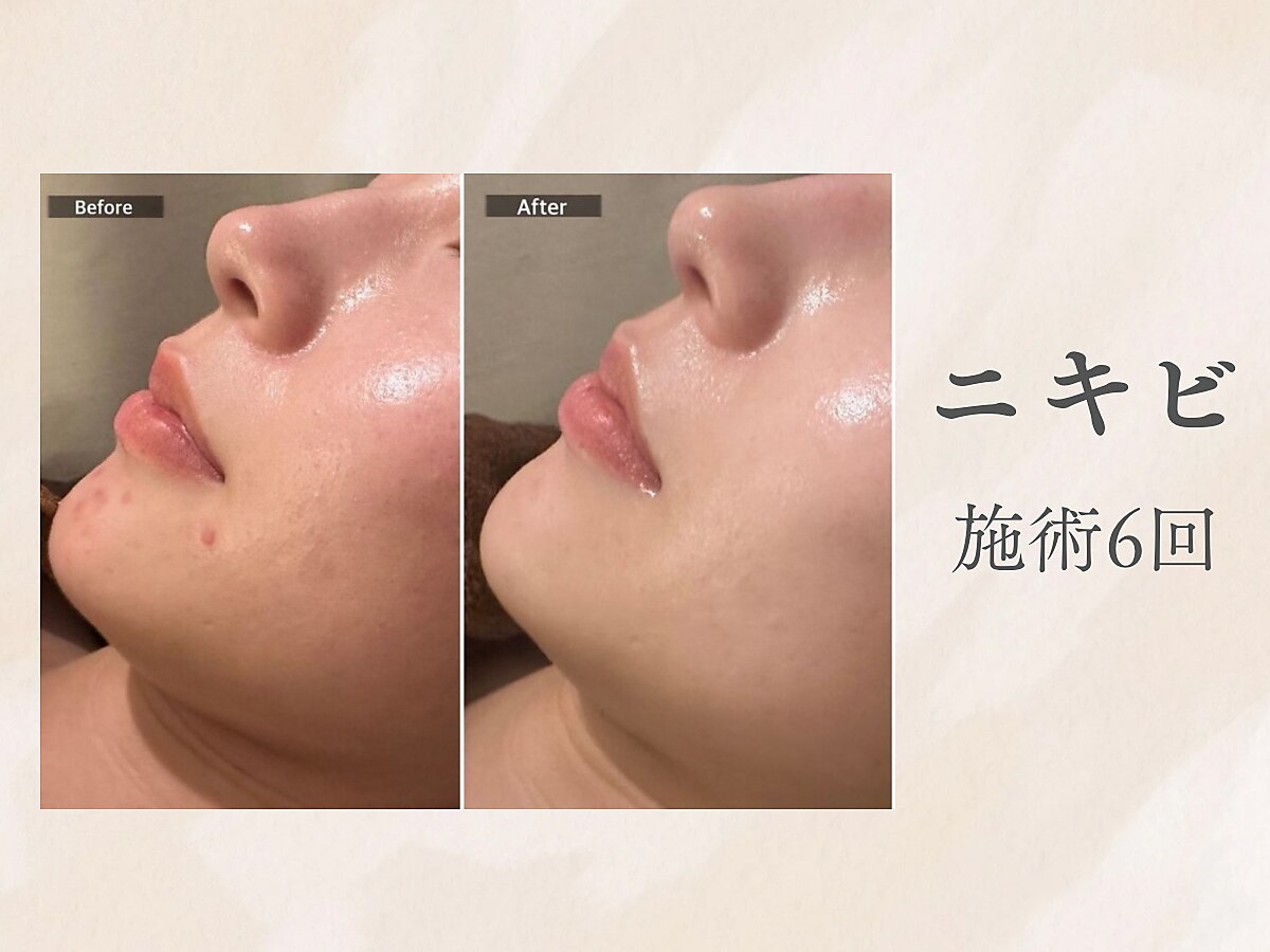 フラーブ(Flourb)｜ホットペッパービューティー