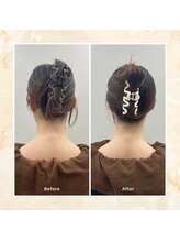 プレメ 人形町院(The Preme)/くびケアスリム　１回施術前後