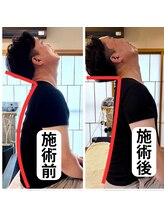 鍼灸整骨院ゼット(Z)/1回の施術でビックリな変化が！