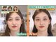 アイケアラボ 江坂駅前店(アイケアLaBo)の写真