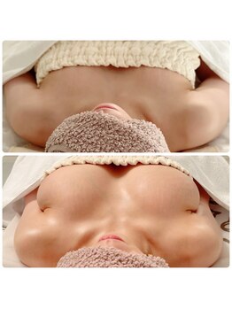 カナエルサロン 旭川(KANAERU SALON)/【バストアップ】症例☆