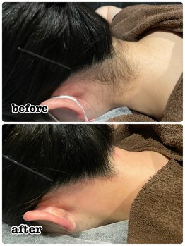 ビアス(Biasu)/うなじ シュガーリングwax