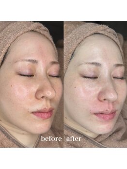 ルミナス(Luminous)/ララピール