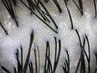 【平日14～16時限定】頭皮が見れるカウンセリング！！（約15分)