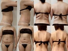 プリマ(Prima)の雰囲気（痩せにくい箇所を集中的にケアしたい方や骨格矯正したい方にも◎）