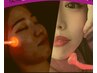 【基本コース】プラズマフェイシャル☆超速小顔&リフトUP・美肌