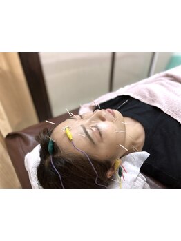 鍼灸施術を受けたい