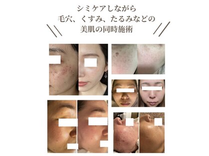 ドットフェイス(.Face)の写真