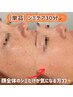 【本気のシミ対策】シミケア30分☆8000円