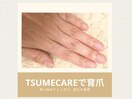 TSUMECAREで育爪☆