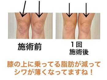 鍼灸サロンオランジュ 高槻富田院/