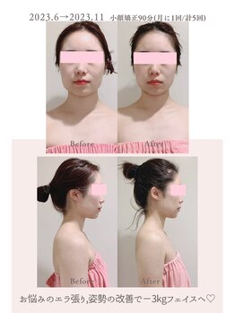 トゥインクル 麻布(twinkle)/麻布十番/シンメトリー小顔矯正