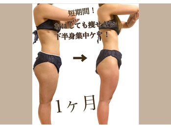 ウェリナポノビューティサロン(welina pono beauty salon)/《痩身/ダイエット/小顔》