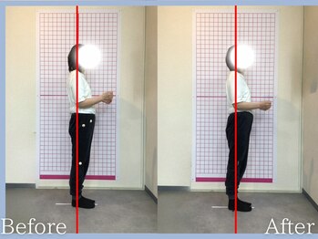 トロ整骨院(toro整骨院)/骨格矯正★1回の効果★40代女性