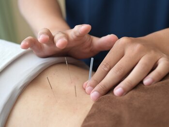 たくあん鍼灸院の写真/【施術豊富な院長によるマンツーマンの施術】お悩みに合わせて、整体と鍼灸の施術を組み合わせ♪