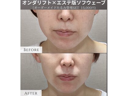 ベル(bell)の写真