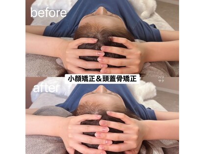 ハリサクの写真