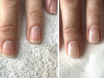 ハンドの休日の写真/自分の手が好きになる。深爪・割れ爪を解消して自信あふれる手元美へ。