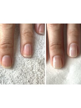 爪の悩みを解消できる（ケア含む）