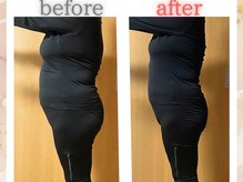 ヨサパーク リリー(YOSA PARK Lily)/