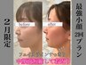 2月★3名限定【絶対小顔になる2回セット】小顔＋たるみ肌に！エラ張りにも◎