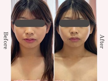 ビューティースタジオ エイワン(A1)/