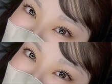 ロレインアイ 佐倉店