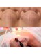 サロンドミジュ(Salon de 美jyu)の写真/頑固な鼻・黒ずみ角栓オフ！うる艶肌へ導く超音波毛穴洗浄＆顔脱毛付！◎
