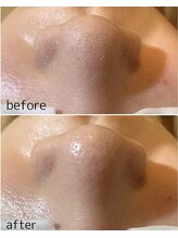 トータルビューティーサロン シフォン(Cfon)/