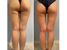 ルナグランデ(Luna grande.)/美脚＆美尻！