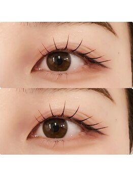 コンジュ ファースト 土橋店(CONJU 1st)/メーテルロッド