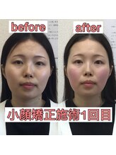 オズ六本木/気持ち良い施術で小顔美人に☆