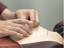 かえで鍼灸整体院/鍼（はり）★