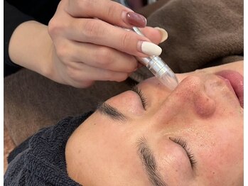 ピノ 西尾店(PINO)/【メンズフェイシャル】毛穴洗浄