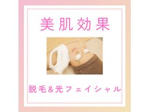 ノノ(nono)の雰囲気（お顔から足の指まで全身脱毛！光フェイシャルでつや,ハリ,小顔♪）