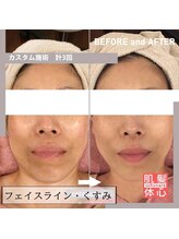 アンナカルナ(AnnaCarna)/毎日見てるから気づかないことも