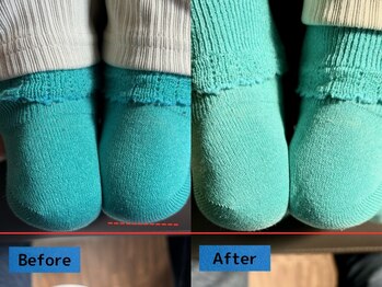 鈴家/施術後は長さがそろってきます！