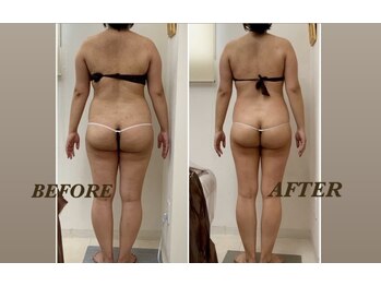 プリマ 栄店(Prima)/BEFORE&AFTER